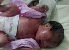 上海集爱医院三代试管婴儿费用多少？上海做三代试管婴儿医院哪家医院排名好？